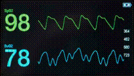 Venous Oximetry